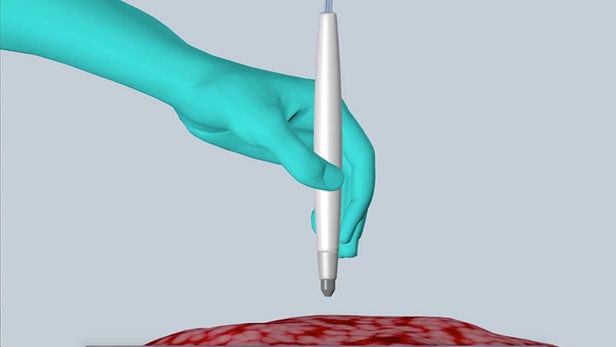 pen-cancer-tissue-1.jpg